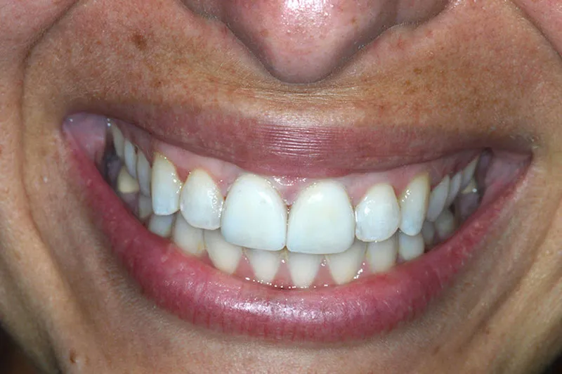 Before and After Case 1