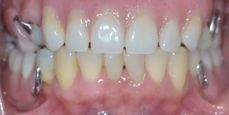 Before and After Case 4