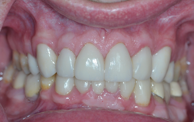 Before and After Case 5