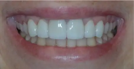 Before and After Case 1