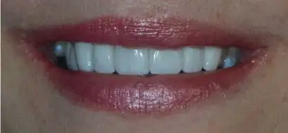 Before and After Case 2