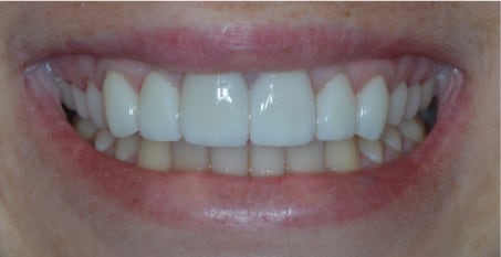 Before and After Case 1
